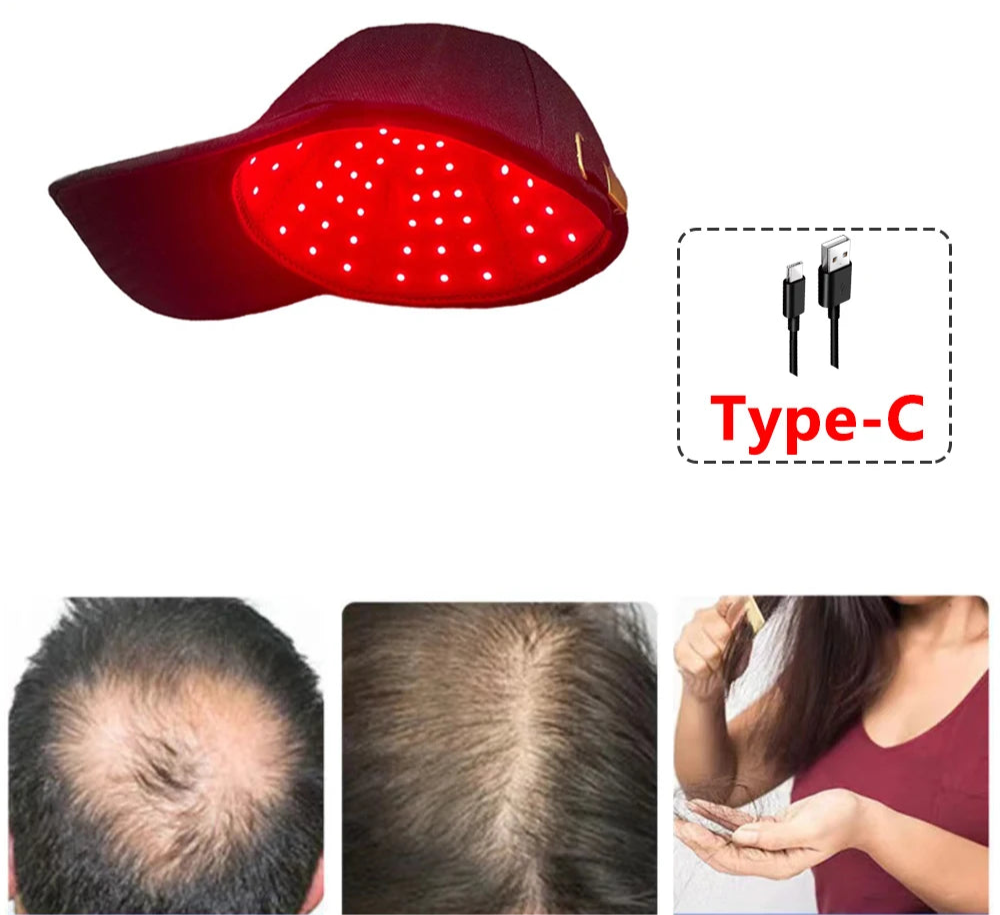 Hair Regrowth Laser Therapy Cap - Evonix